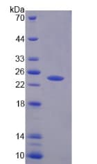 Human PTPRN2 / Phogrin Protein (Recombinant)