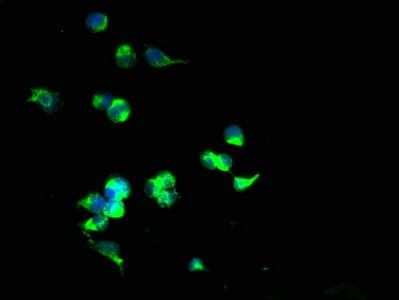 Polyclonal Rabbit anti-Human SLC25A40 Antibody