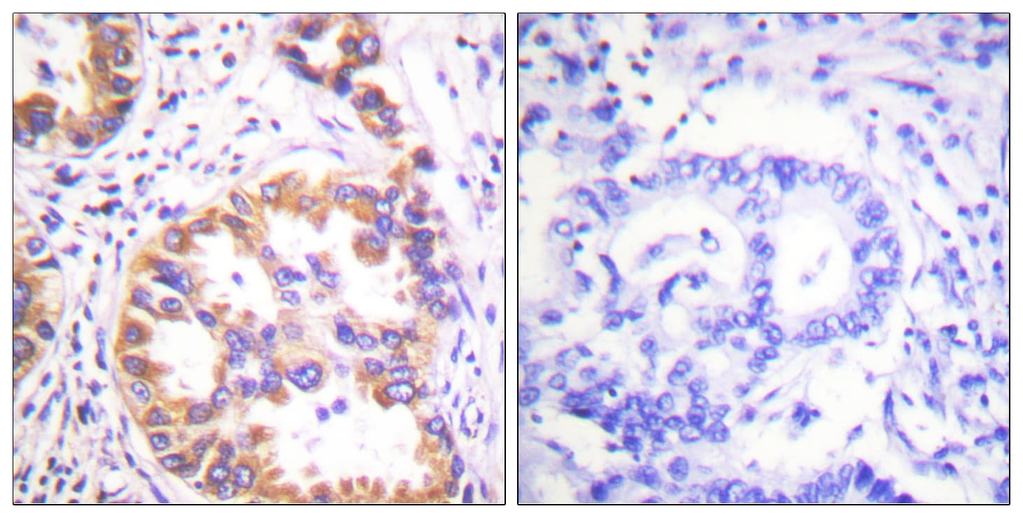 Tuberin / TSC2 Antibody (phospho-Ser939)