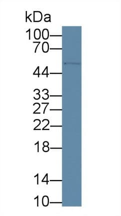 CD5 Antibody