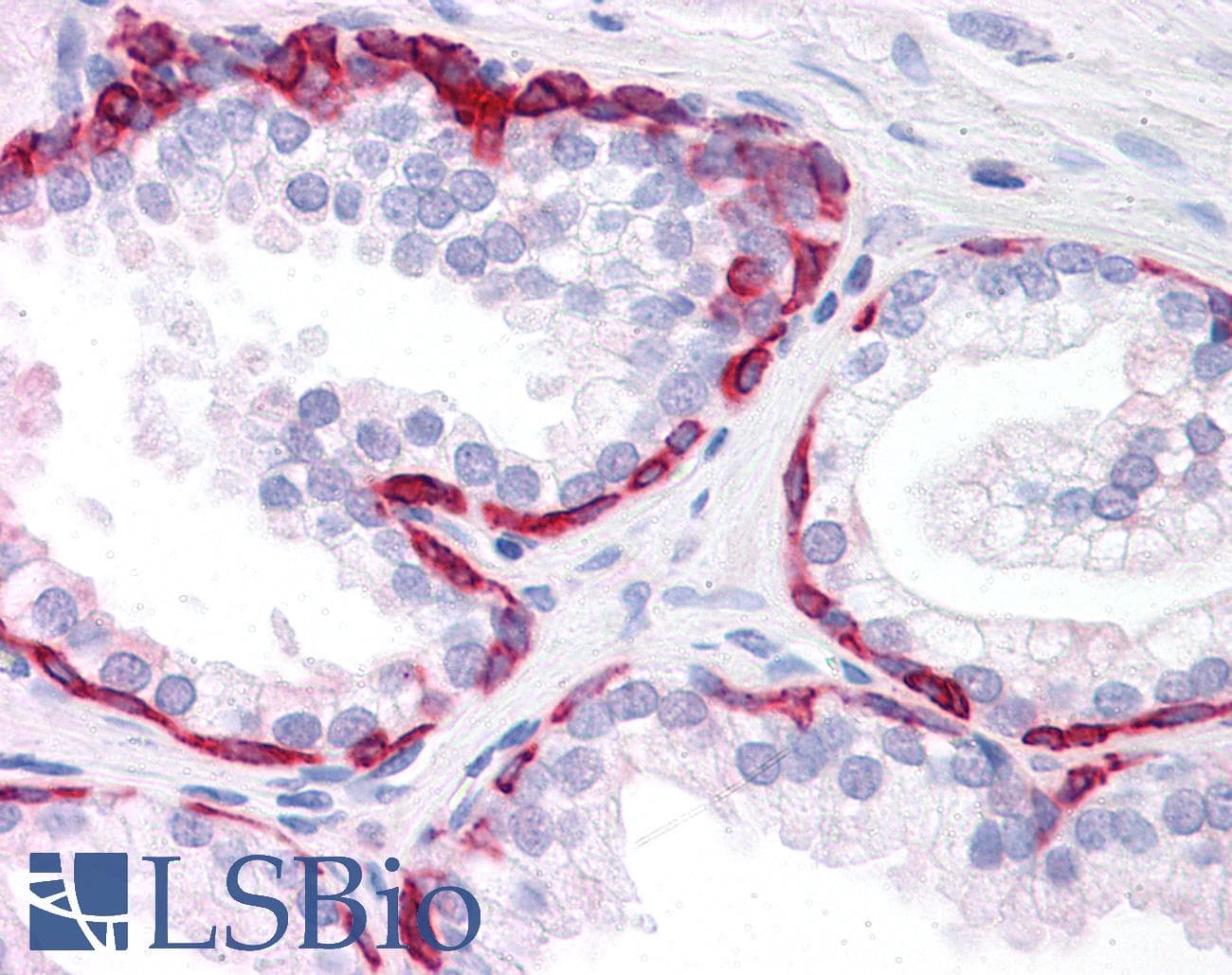 PathPlus™ KRT20 / CK20 / Cytokeratin 20 Antibody (clone 2G3-1C8)