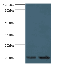 Polyclonal Rabbit anti-Human ARF6 Antibody (aa1-175, IHC, WB)