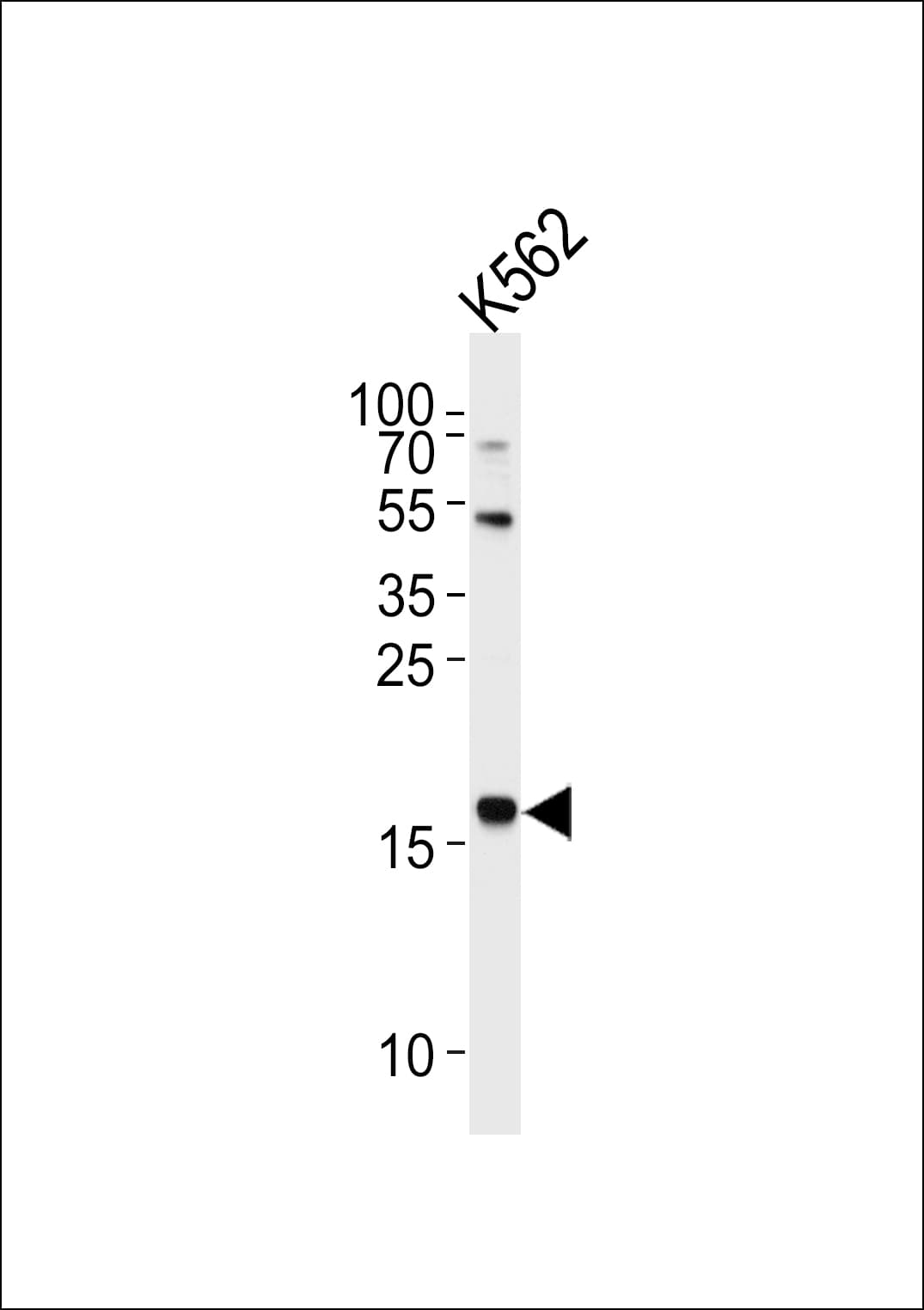 Polyclonal Rabbit anti-Human NAT14 Antibody (aa5-33, IHC, WB)