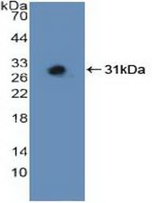 MAP2K3 / MEK3 / MKK3 Antibody (aa99-343)