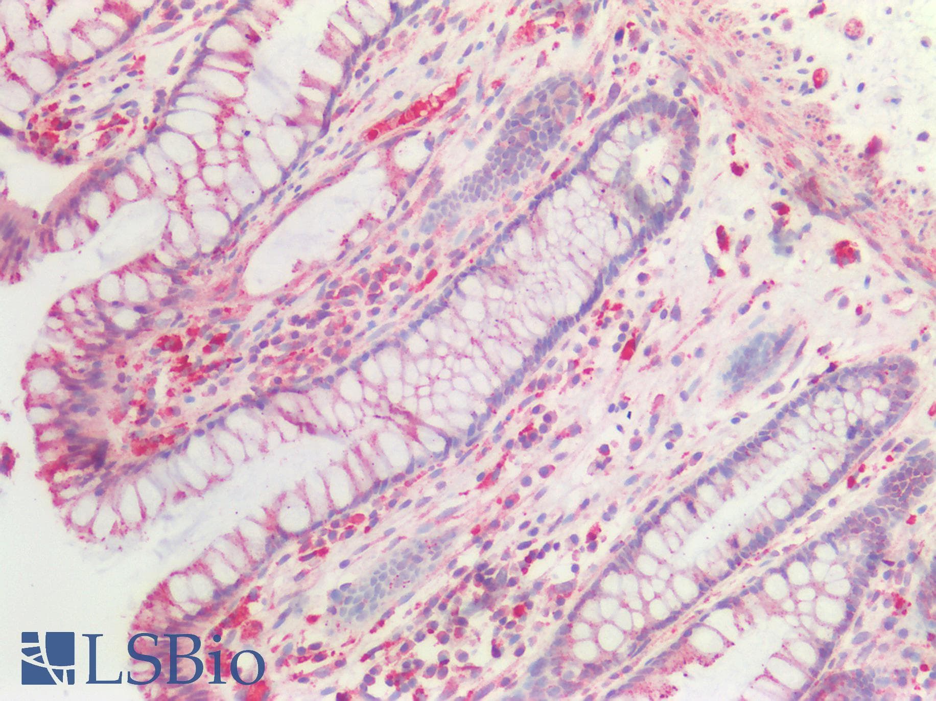 IHC-plus™ Polyclonal Rabbit anti-Human CTSS / Cathepsin S Antibody (aa32-265, IHC, WB)