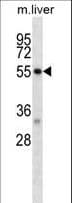 DAPK2 / DAP Kinase 2 Antibody (aa38-65)
