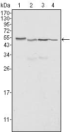 IHC-plus™ Monoclonal Mouse anti-Human CALR3 Antibody (clone 1G6A7, IHC, IF, WB)