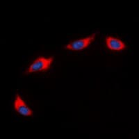 CXCR2 Antibody (C-Terminus)