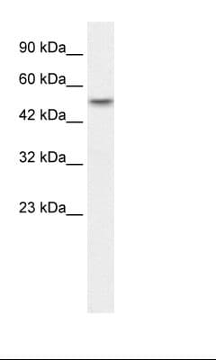 ANKRD11 Antibody (aa57-106)
