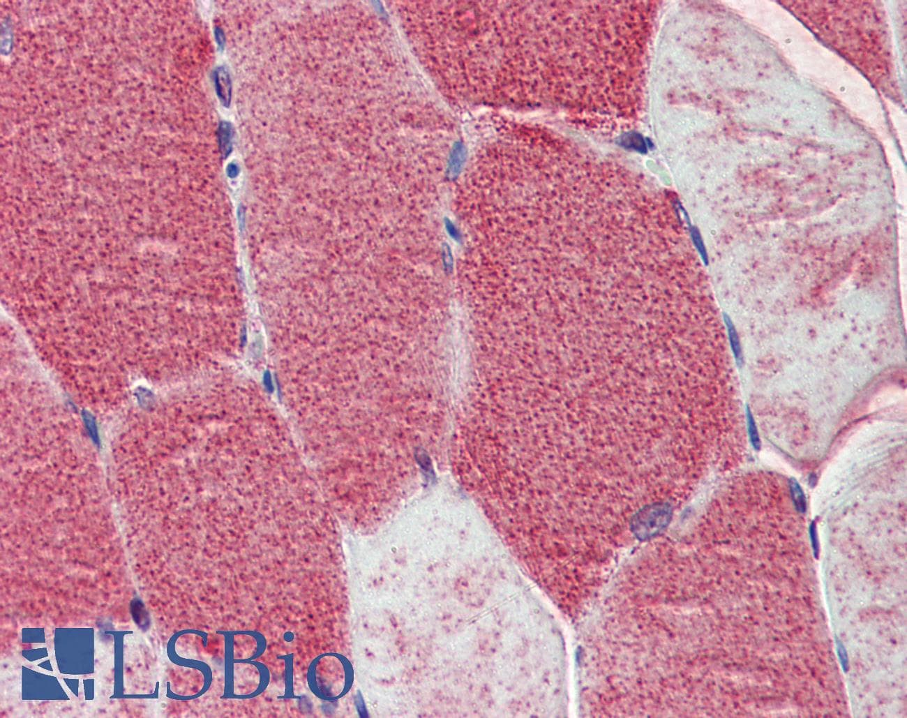 IHC-plus™ Polyclonal Rabbit anti-Human POLG Antibody (IHC, IF, WB)