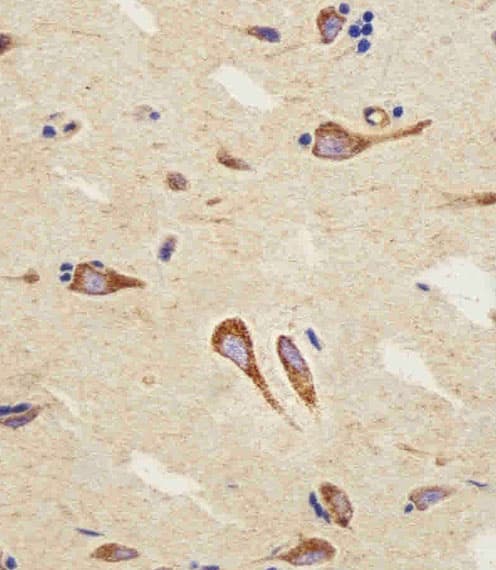 Polyclonal Rabbit anti-Human CNR2 / CB2 Antibody (aa329-356, IHC, WB)