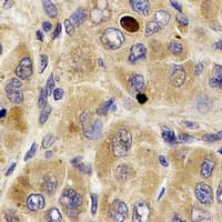 MPP2 Antibody