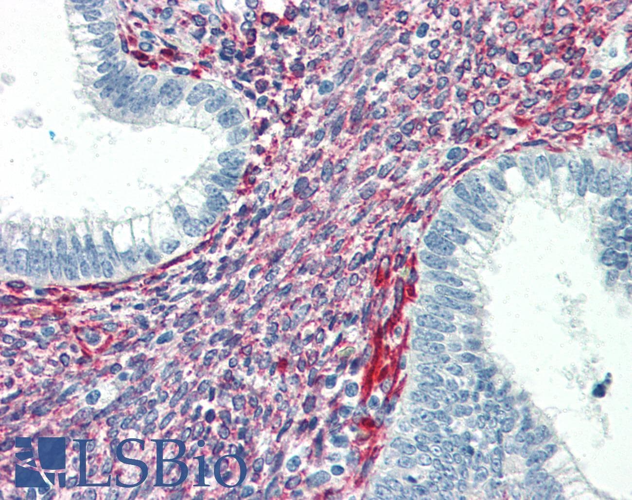 IHC-plus™ SERPINH1 / HSP47 Antibody (clone M16.10A1)
