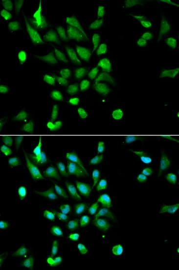 Polyclonal Rabbit anti-Human PSMC5 / SUG1 Antibody (IHC, IF, WB)