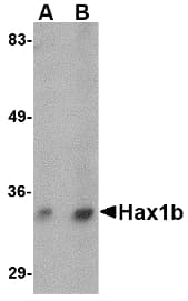 Polyclonal Rabbit anti-Human HAX-1 Antibody (WB)