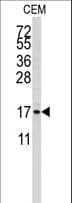 Calgizzarin / S100A11 Antibody (Ser6)