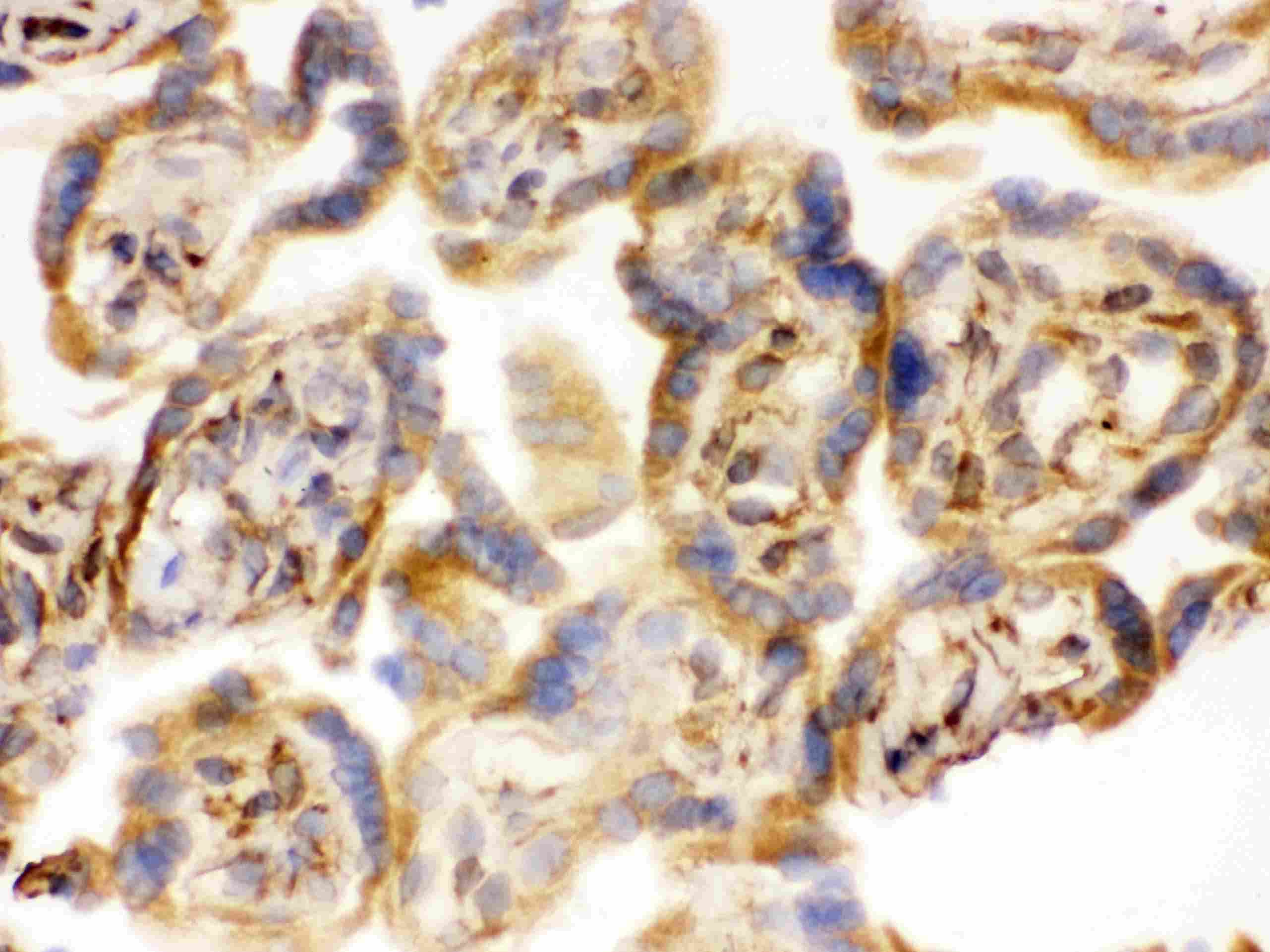COMT Antibody (aa52-271)