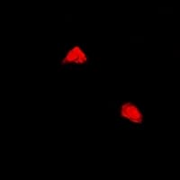 PPP2R2A Antibody