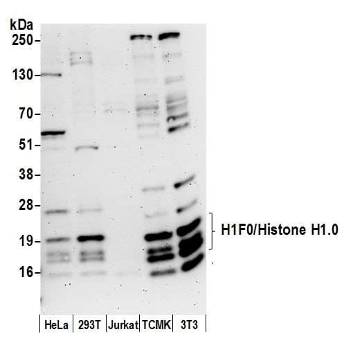 Polyclonal Rabbit anti-Human H1F0 Antibody (aa75-125, WB)