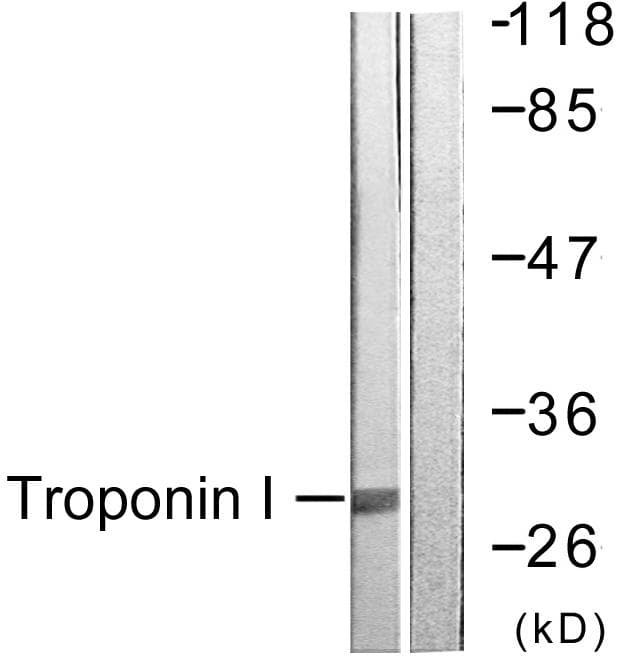 TNNI3 / Cardiac Troponin I Antibody (p43)