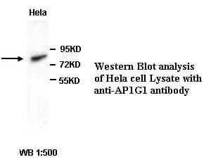 Polyclonal Rabbit anti-Human AP1G1 / Adaptin Gamma 1 Antibody (IHC, WB)