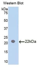 IL18BP Antibody (aa29-193)