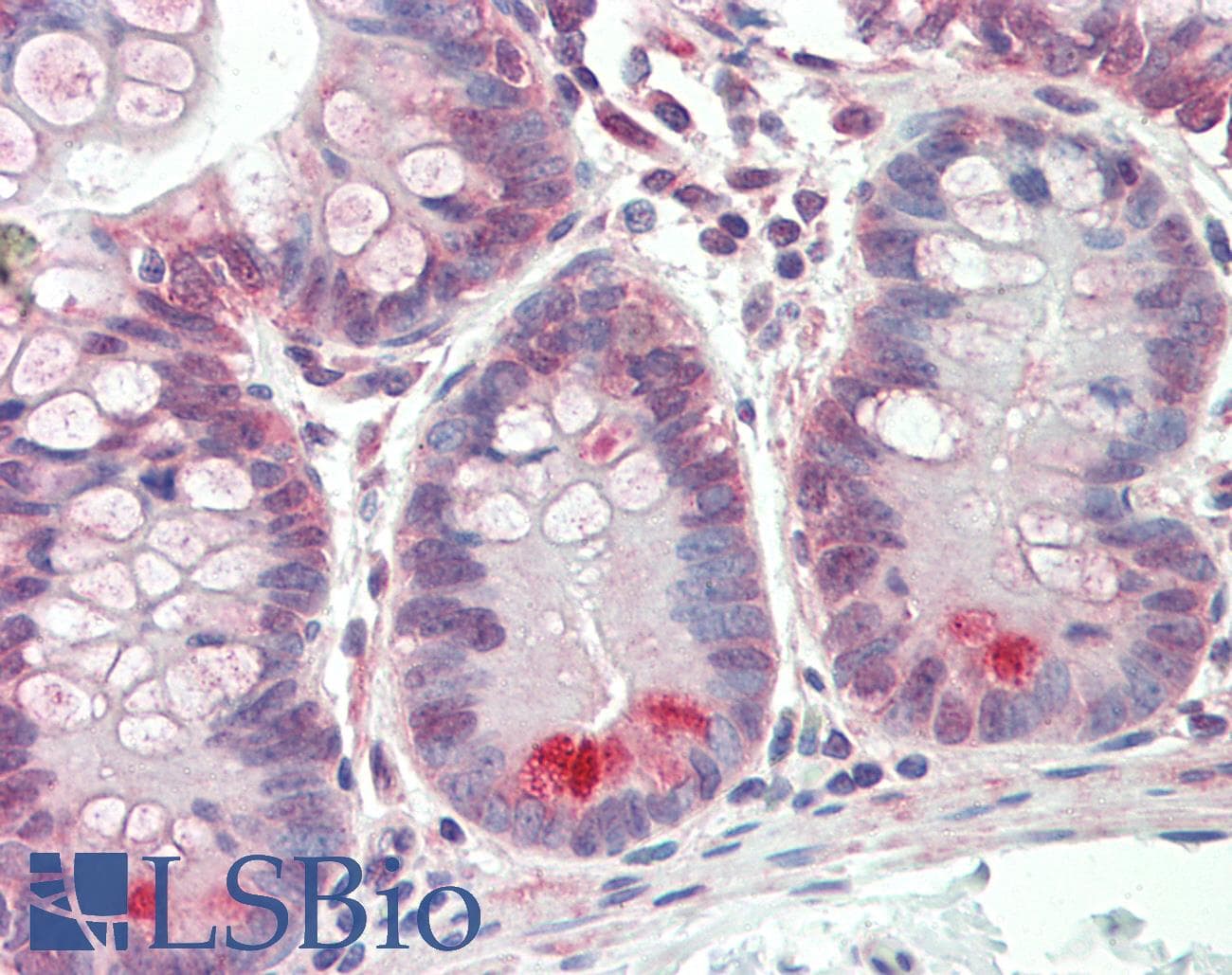 GUCA2A / Guanylin Antibody (aa56-105)