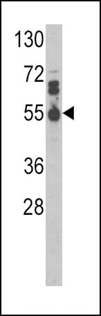 IL17RB Antibody (aa207-234)