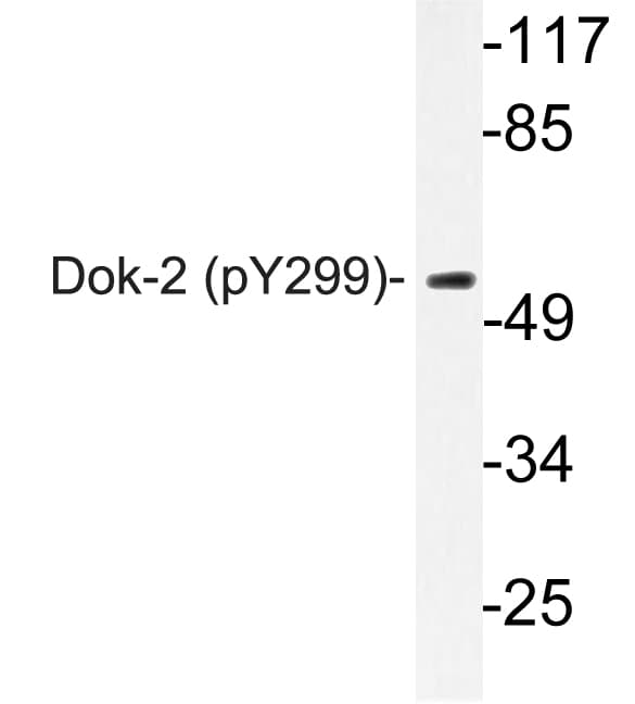 DOK2 Antibody (phospho-Tyr299)