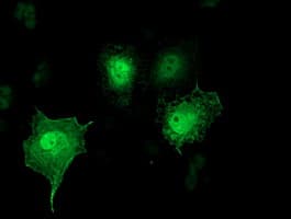 SH2D2A Antibody (clone OTI4F3)