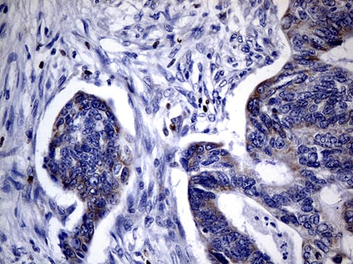 FOXP3 Antibody (clone OTI3D1, Carrier-free)