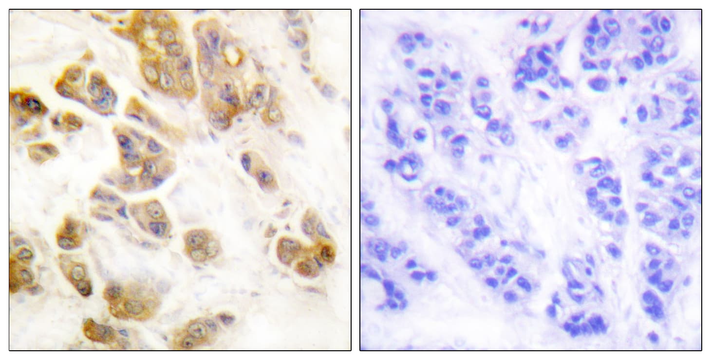 CAMK1 / CAMKI Antibody (phospho-Thr177)