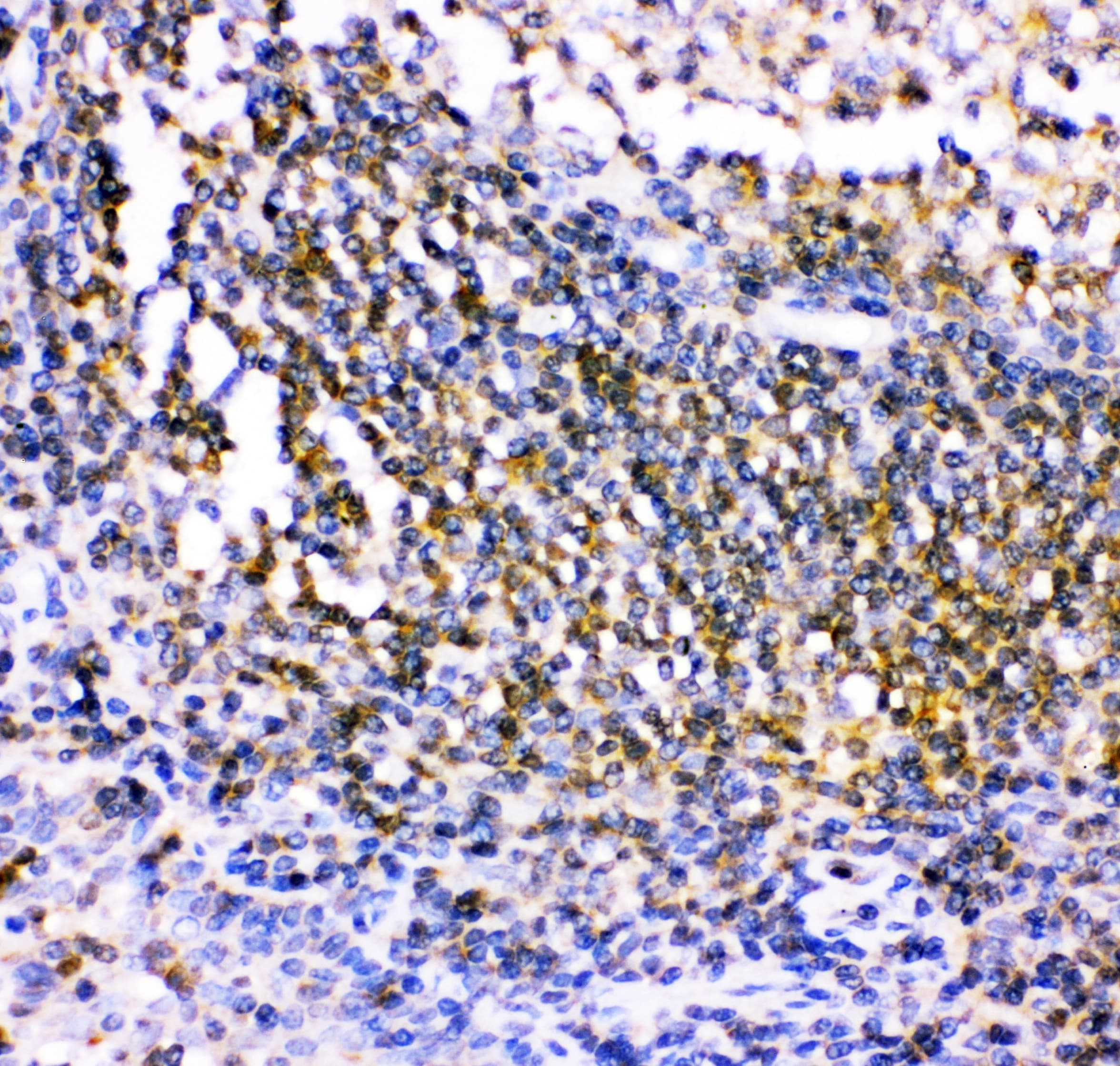 Polyclonal Rabbit anti-Human c-Src Kinase / CSK Antibody (aa2-204, IHC, WB)
