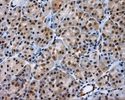 LIPG / Endothelial Lipase Antibody (clone OTI6E11)