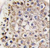 MAP1LC3B / LC3B Antibody (aa77-106)