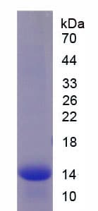 Rat LHB / Luteinizing Hormone Protein (Recombinant His, N-Terminal)