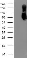 IHC-plus™ MAC-2-BP / LGALS3BP Antibody (clone 2B1)