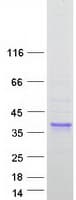 Human SFTPA1 / Surfactant Protein A (Recombinant Myc-DDK (Flag))
