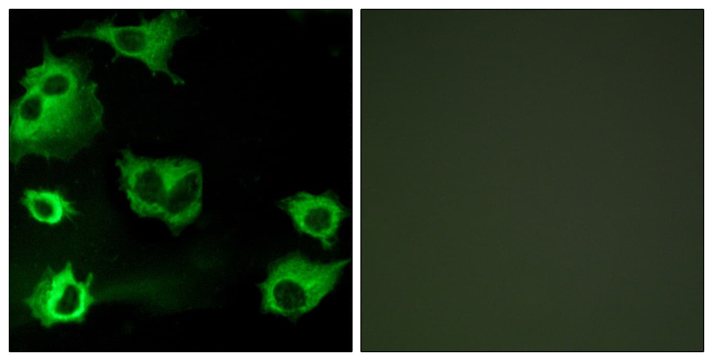 IHC-plus™ CYSLTR1 / CYSLT1 Antibody (aa131-180)
