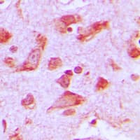 PJA2 Antibody (Internal)