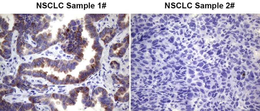 ROS1 / ROS Antibody (aa1882-2125, clone OTI1A1, Carrier-free)