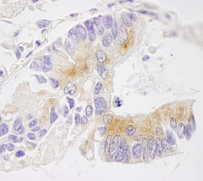 EML4 Antibody (aa150-200)
