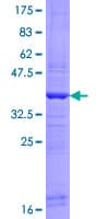 Human MMP21 Protein (Recombinant GST, N-terminus)