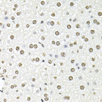 FBL / FIB / Fibrillarin Antibody