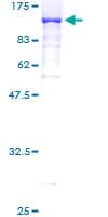 Human DNAI1 Protein (Recombinant GST)
