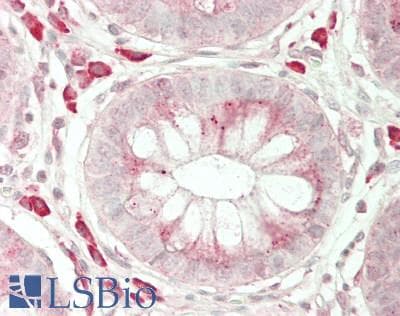 IHC-plus™ Polyclonal Rabbit anti-Human BBS7 Antibody (aa263-540, IHC, WB)