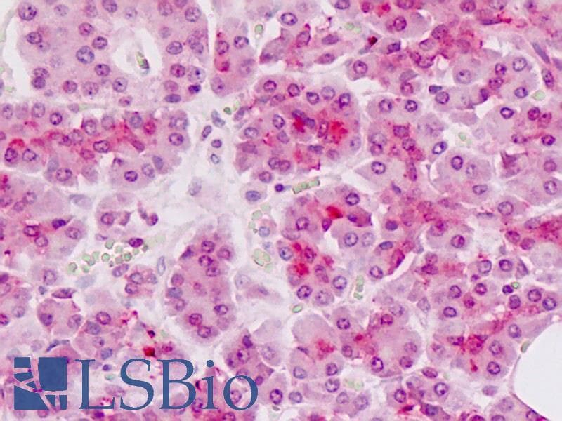 IHC-plus™ Polyclonal Rabbit anti-Human UBXD9 / ASPL Antibody (aa392-418, IHC, WB)