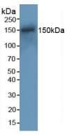 RAD50 Antibody (aa1-234, PE)