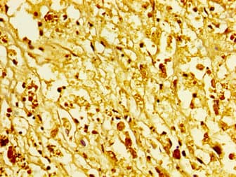 HIST1H1C Antibody