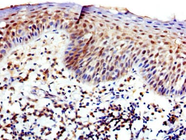 WAS / WASP Antibody